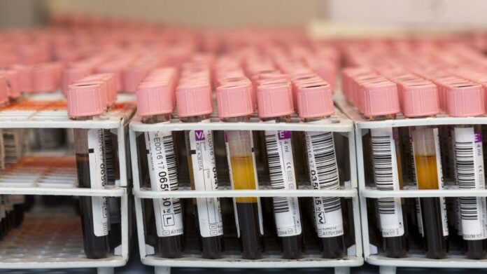 Tubos de sangre de donantes