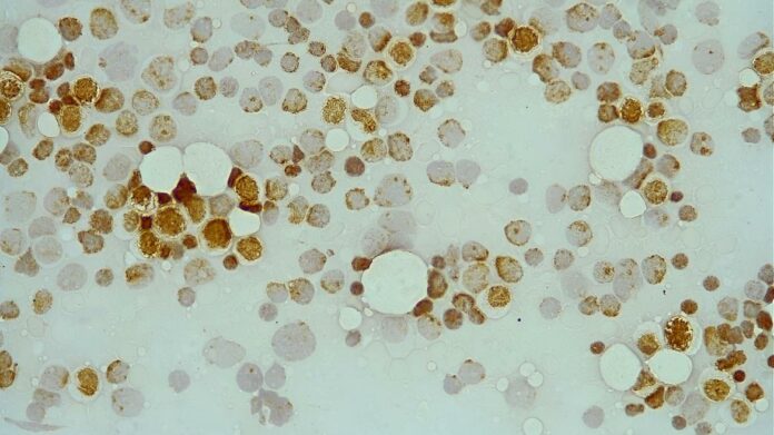 Imagen de células de distintos colores con las de color marrón más destacadas
